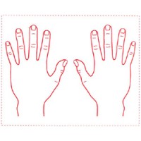 シャチハタ 医療用人体図　「手の甲」　角型印4050号（40x50mm）病院/医院/整骨院/ゴム印/スタンプ