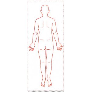 シャチハタ 医療用人体図　「全身（背面）」　角型印40100号（40x100mm）病院/医院/整骨院/ゴム印/スタンプ